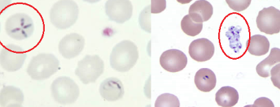 <p>The following organisms were seen on peripheral blood smears from a patient with recent travel to Connecticut. What is it?</p>