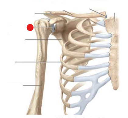 <p>Identify the structure pinned</p>
