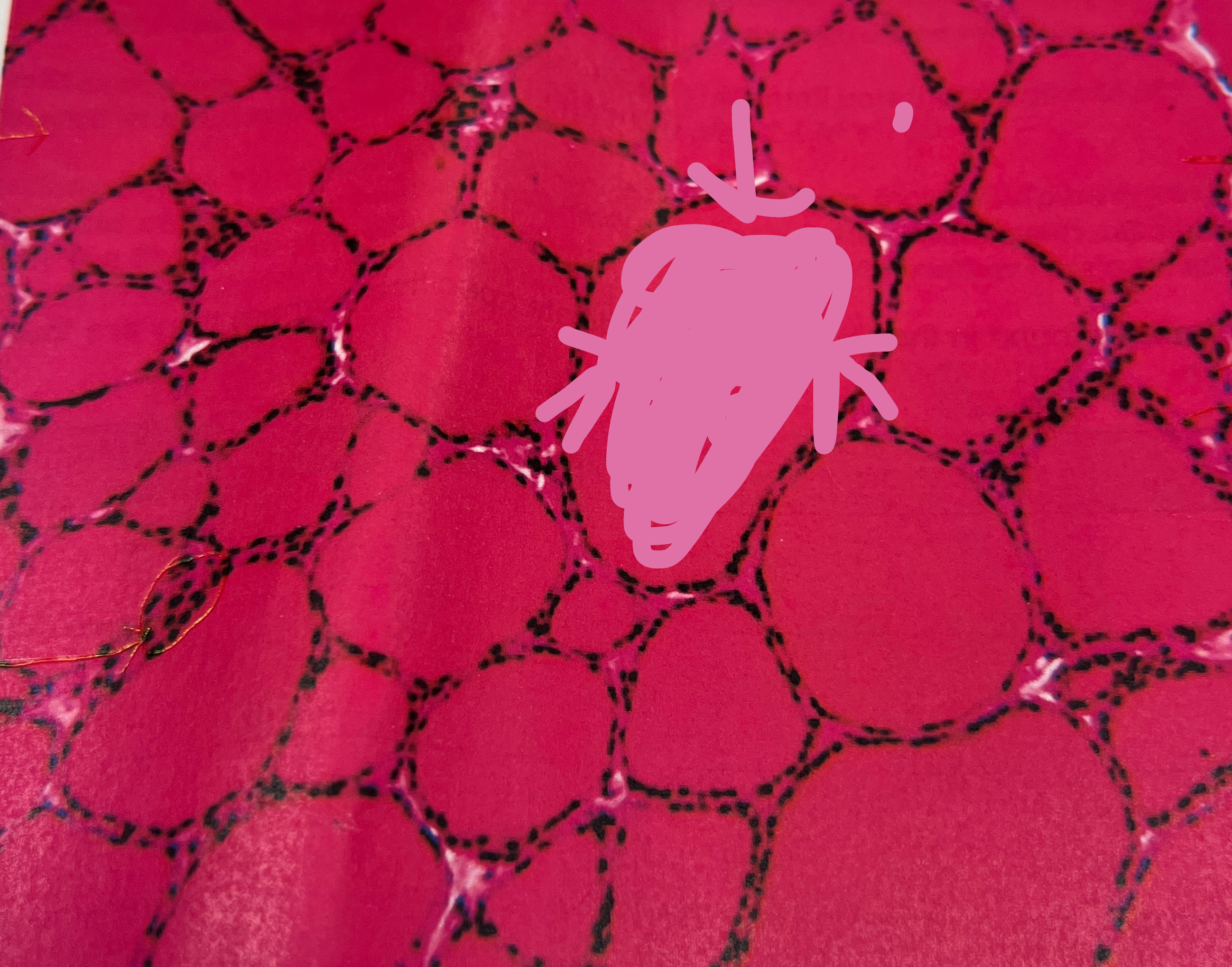 <p>What is the pink liquid inside of the follicle called in the thyroid gland?</p>