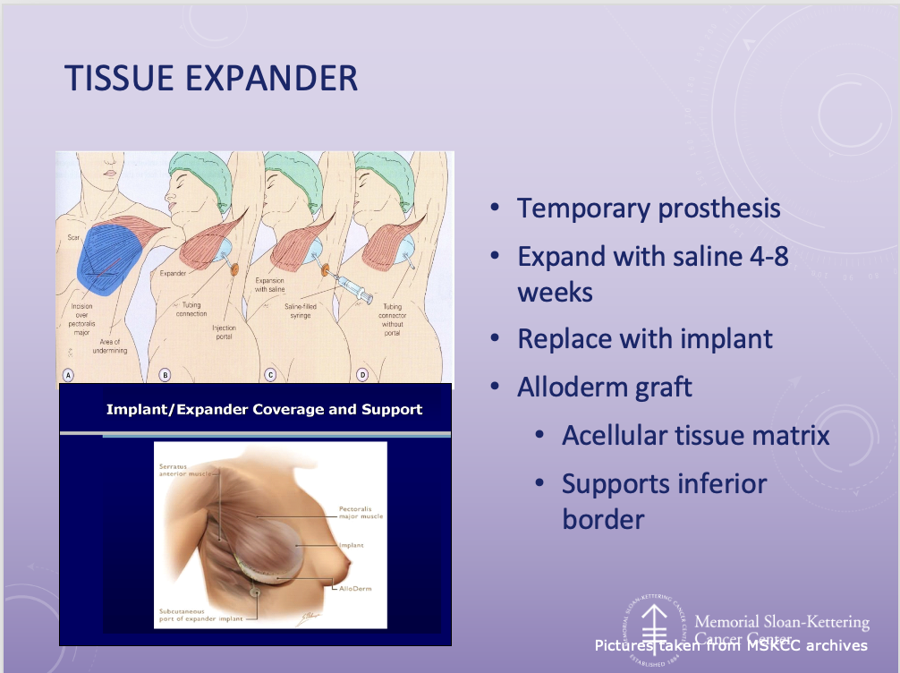 <p><span>Rotationplasty is another limb salvage procedure. This is performed with tumors of distal femur whose skeletal growth is not yet complete. The femur is amputated at the proximal growth plate. The tibia is then rotated 180 degrees and then fused to the femural stump.</span></p><p style="text-align: left;"></p><p><span>❑Indications</span></p><p><span>❑Tumors of the distal femur</span></p><p><span>❑Age of patient</span></p><p style="text-align: left;"></p><p style="text-align: left;"></p><p style="text-align: left;"></p><p><span>❑Procedure</span></p><p><span>❑Amputation of limb at distal femur</span></p><p><span>❑Rotate tibia and reinsert to residual limb</span></p>