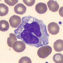 <p>located in the kidney or a large oval-shaped nucleus </p>