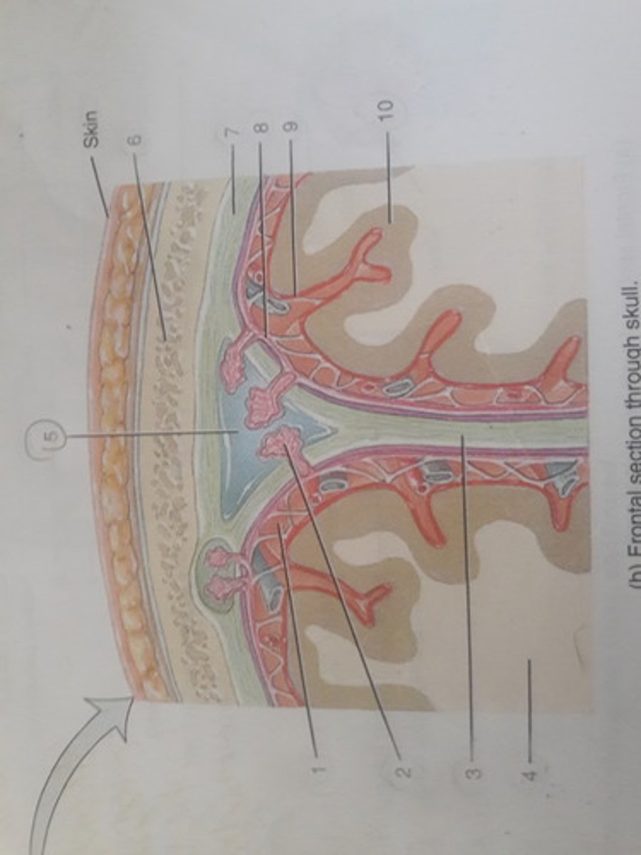 <p>Located superior to the longitudinal fissure, is one of the main dural sinuses.</p>