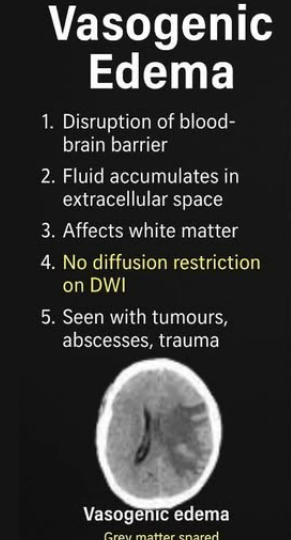 <p>VASOGENIC EDEMA</p>