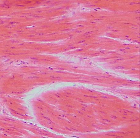<p>is located in the walls of hollow organs, like uterus </p>