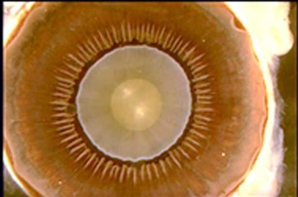<p>label structures of the anterior eye </p>