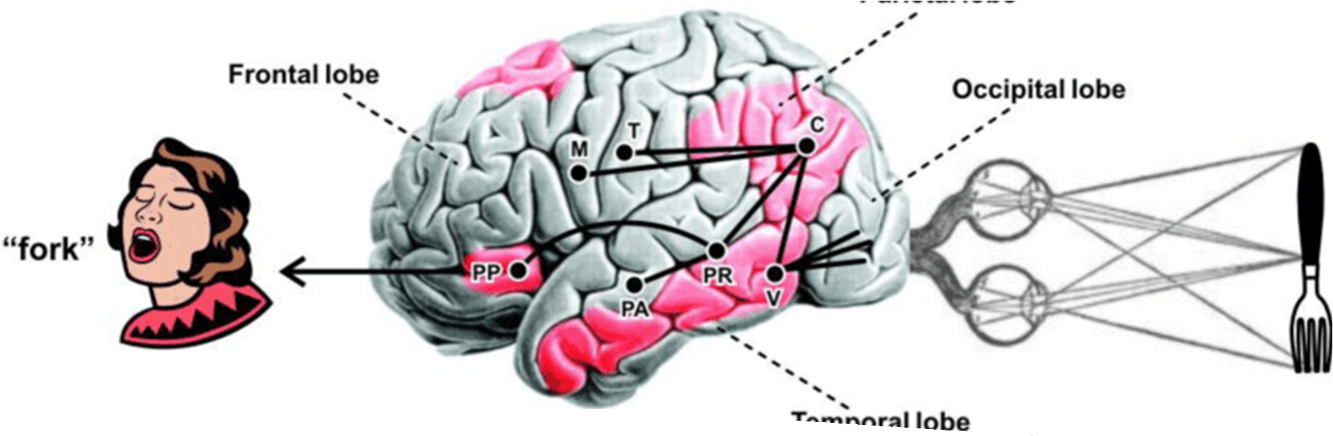 <ul><li><p><span style="font-family: "Arial Nova Light";">Language is predominantly a left hemisphere (LH) function.</span></p></li></ul><p></p><ul><li><p><span style="font-family: "Arial Nova Light";">For most people, language is processed in the left hemisphere.</span></p></li><li><p><span style="font-family: "Arial Nova Light";">Pink areas show those most commonly used, even if say occipital lobe, is used in speech.</span></p></li><li><p><span style="font-family: "Arial Nova Light";">In deaf people, the cortical areas devoted to sign language are the same as for spoken languages. Same parts light up.</span></p></li><li><p><span style="font-family: "Arial Nova Light";">Therefore, the regions of the brain devote to language are specialised for symbolic representation and communication (not specifically spoken, heard, signing language).</span></p></li><li><p><span style="font-family: "Arial Nova Light";">Left handed people are less likely to be solely left hemisphere for language, but more spread out. That's why experiments use right handed people.</span></p></li><li><p><span style="font-family: "Arial Nova Light";">Ambidexterity is not having consistent left or right hand. They're a scale. You do different things with different hands. Write on paper with right hand, on board with left.</span></p></li><li><p><span style="font-family: "Arial Nova Light";">Deaf people would have more visual stuff, blind people would have more motor / touch stuff. But gesture activates Broca's area and visual cortex.</span></p></li><li><p><span style="font-family: "Arial Nova Light";">This links to theory of language evolution- that we gestured before we spoke. Use of gesture predates use of tools. Children who sign use the same errors of grammar as speaking kids. We all naturally gesture, even when others aren't looking.</span></p></li><li><p><span style="font-family: "Arial Nova Light";">People with damaged Broca's area often also have right-side paralysis, because Broca's area is next to motor cortex.</span></p></li></ul><p></p>