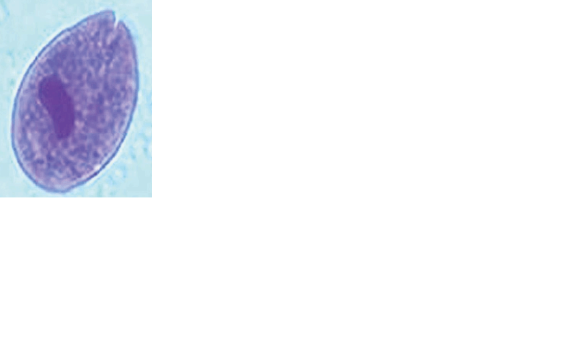 <p>Name the protozoan</p>