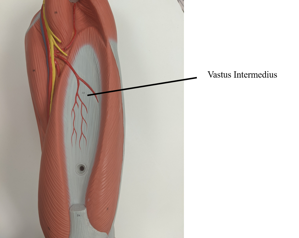 <p>under rectus femoris</p>