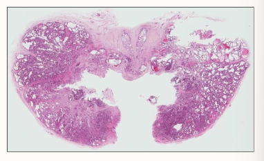 <ul><li><p>bilobed</p></li><li><p>dorsal and ventral midline sulcus</p></li><li><p>entirely surrounds the urethra</p></li></ul><p></p>