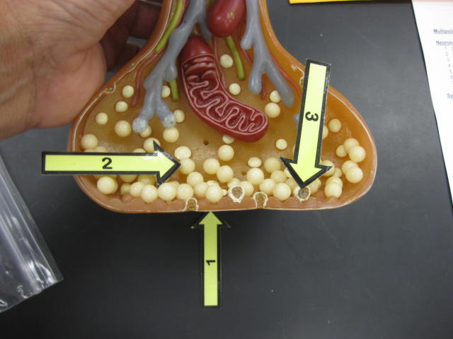 <p>Identify 1, 2, and 3?</p><p>Lab Image 10-4</p>