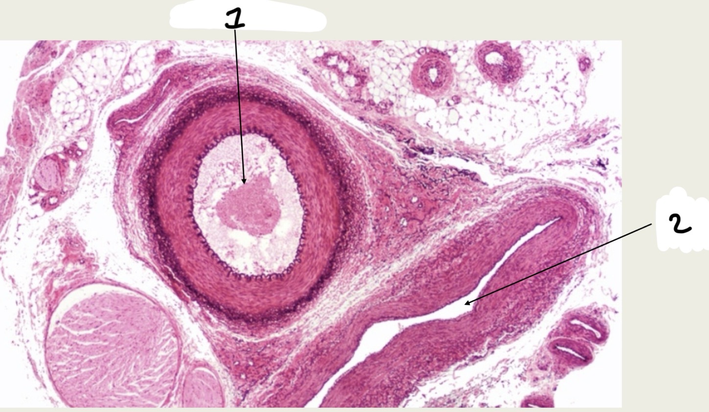 <p>1.XX</p><p>2.XX</p>