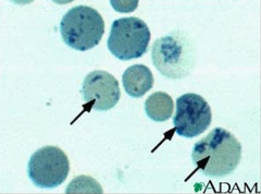 <p>New Methylene Blue</p>