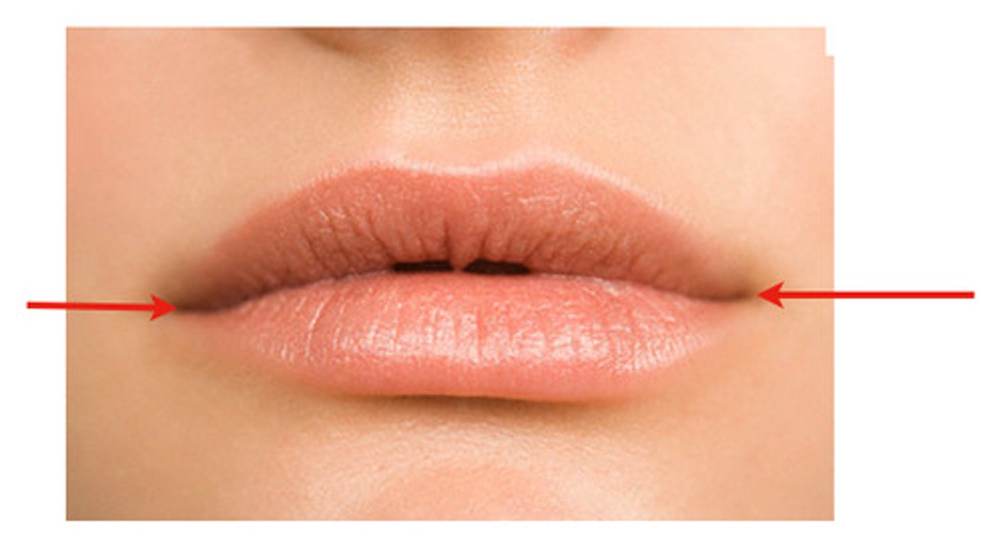 <p>the place where the lateral aspects of the vermilion of the upper and lower lips join</p>