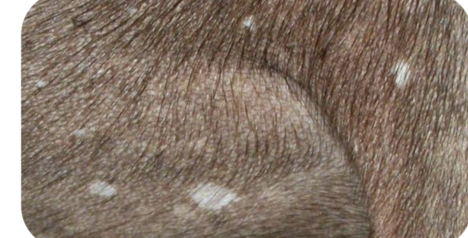 <p>What primary lesion is this? (<1 cm) </p>
