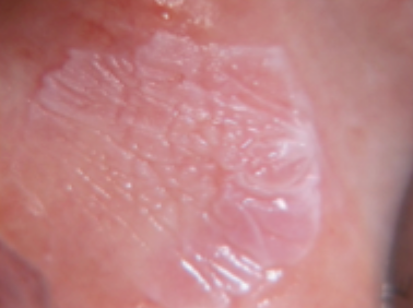 <p>what is this condition</p>