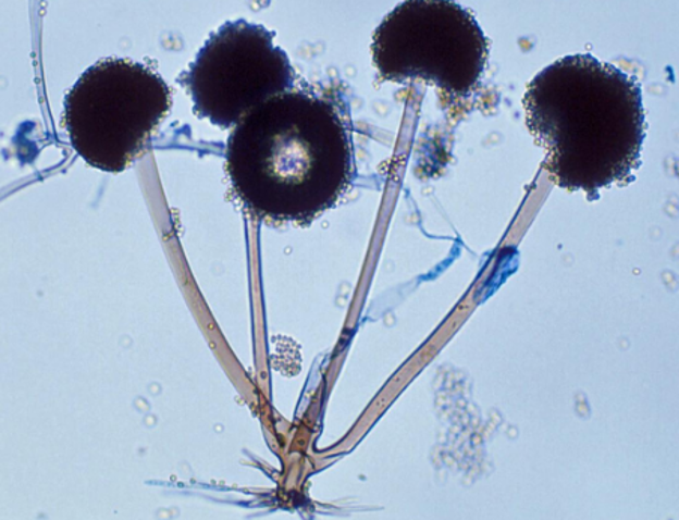 <p>Identify this fungus</p>
