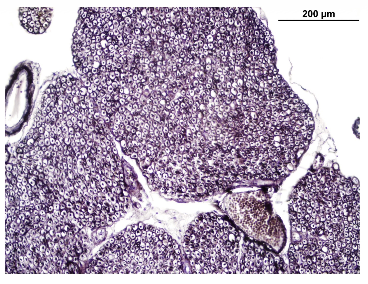 <p>Describe in details the image. </p><p>Starts by type of tissue followed by the structures within it and the CT around and in between the structures. </p>
