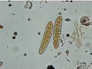 <p>Type of mold? </p>