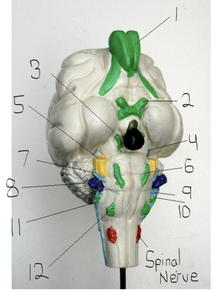 <p>What organ is shown in 3?</p>