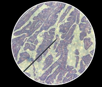 <p>What is the diagnosis?</p>