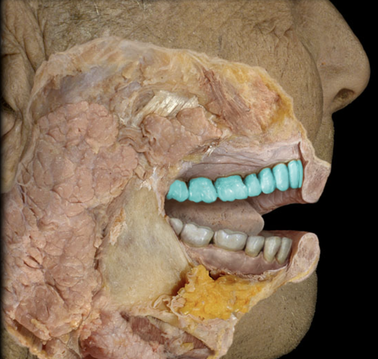 term image
