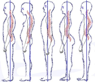 <p>What Abnormal Curvature?</p>