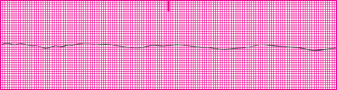 <p>What rhythm is this?</p>