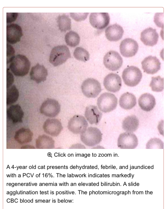 <ol><li><p>Doxycycline + Prednisolone</p><ol><li><p>A steroid is also given because there is rampant RBC destruction via immune system (+ agglutination test)</p></li></ol></li></ol><p></p>