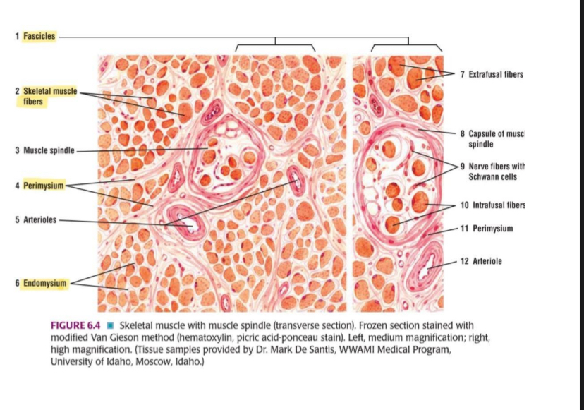 <p>What type of tissue is this?</p>