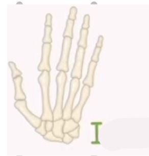 <p>name the bone and the bone shape:</p>