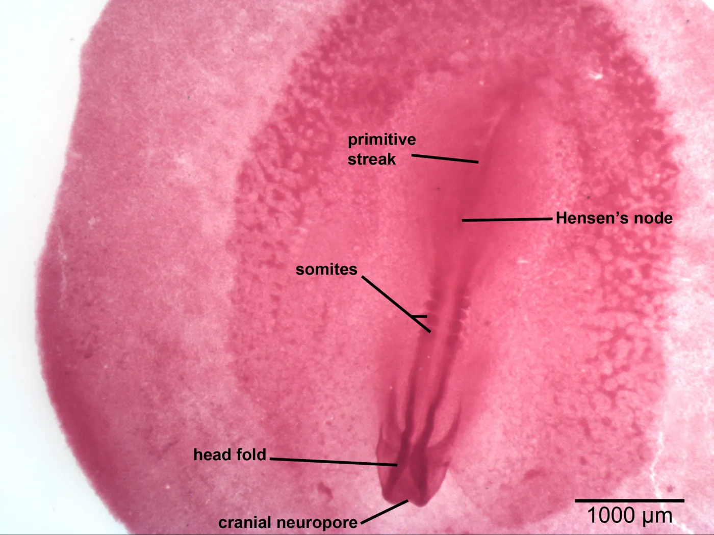 <p>cranial neuropore</p>