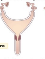 <p>Whose uterus is this</p>