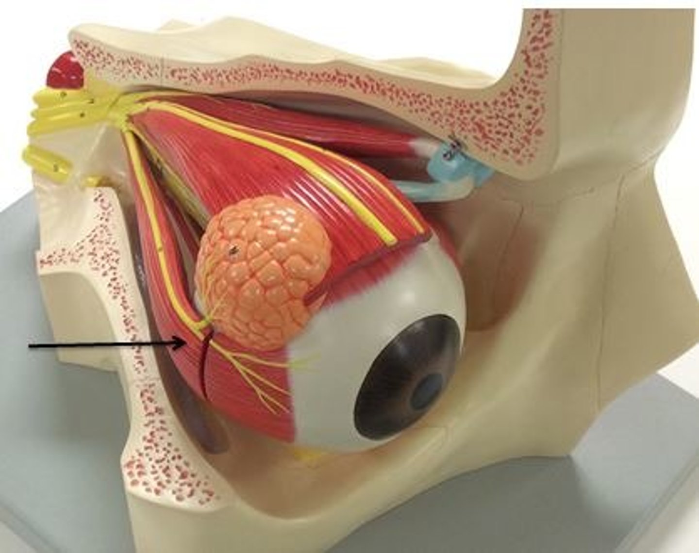 <p>Identify this muscle.</p>