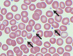 <p>repair small holes in blood vessels </p>