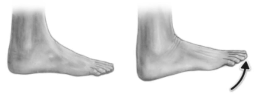 <p>______ is movement of the foot that brings your foot upward toward your shin</p>