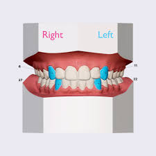 <p>long crowns, used for seizing, pinching, tearing </p>