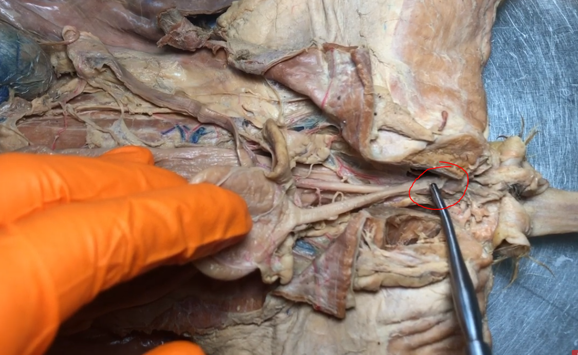 <p>What is this opening on the cat where the vagina and the urethra combine </p>