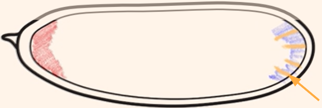 <p>Which cytoplasmic determinant is shown in the figure?</p>