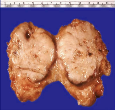 <p>What pathology?</p>