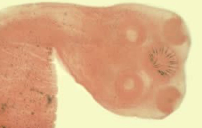 <p>What Helminth is this?</p>