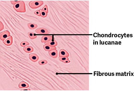 <p>Is tough due to it’s thick bundles of collagen fibers dispersed through it’s matrix. </p><p><span style="color: red;">Ex.</span> Menisci in the knee joint the <span style="color: rgb(52, 136, 187);">Intervertebral Discs</span><span>.</span></p>