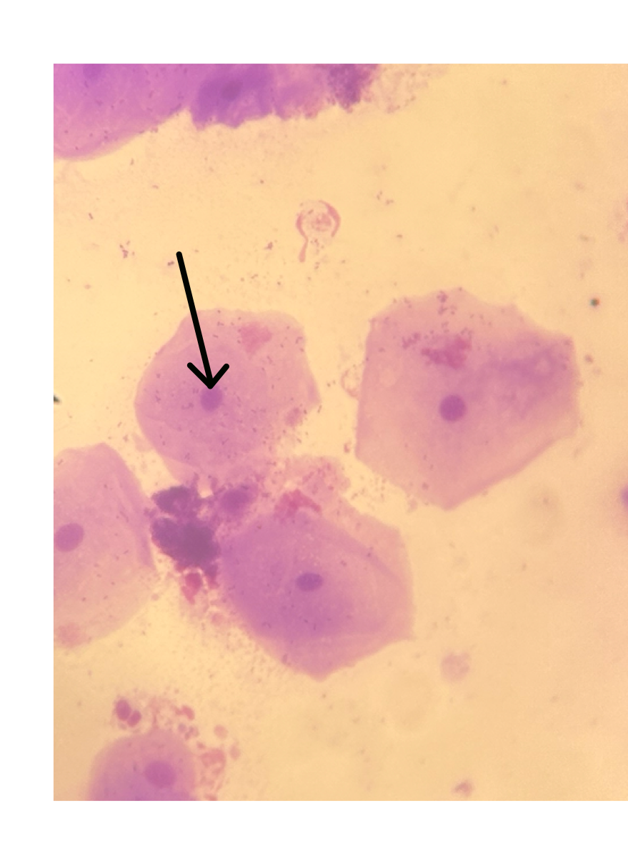 <p>In this Purple stain Human cell what is this</p>