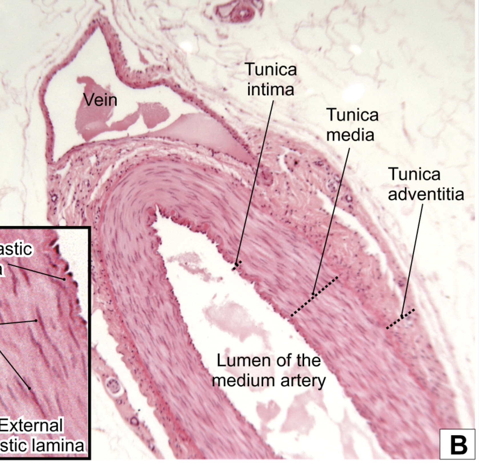 <p>Red: Tunica intima</p><p>Dark green: Tunica media</p><p>Light green: Tunica adventitia</p><p>Yellow: Lumen of the medium artery</p><p>Blue: Vein/Lumen of vein</p>