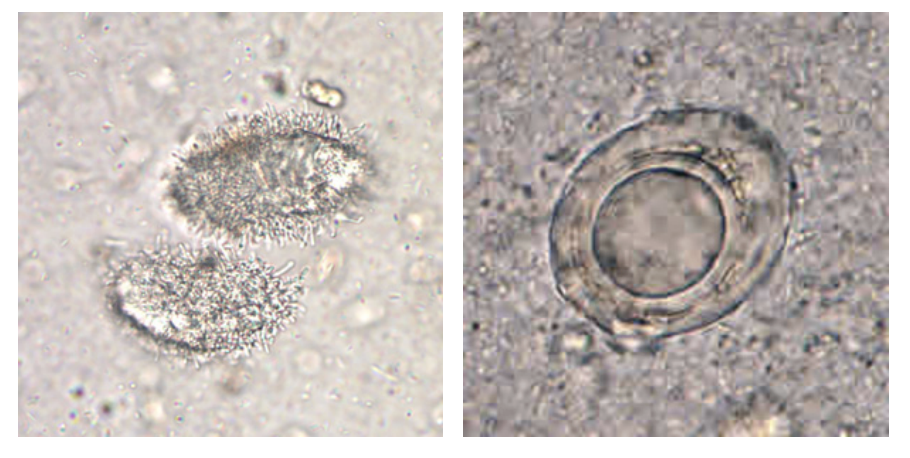 <p>unknown artifacts that look like</p>