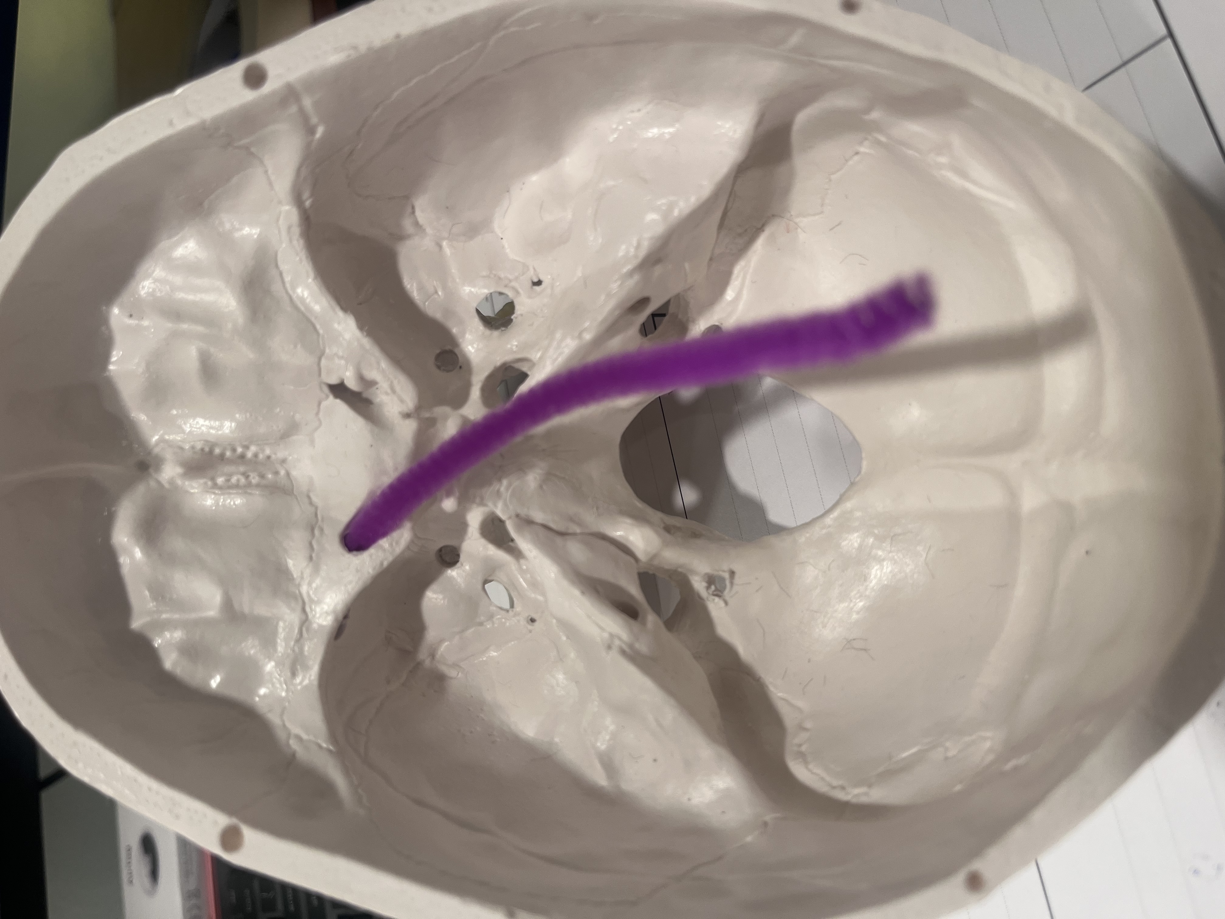 <p>What cranial nerve(s) are represented by the purple pipe cleaner?</p>