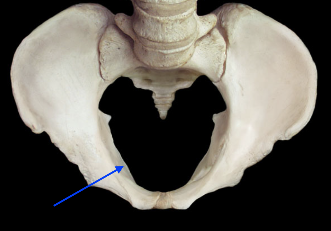 <p>Identify the bone of the pelvis.</p>