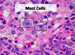 <p>Cells that release chemicals (such as histamine) that promote inflammation.</p>