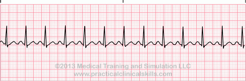<p>What is this rhythm?</p>