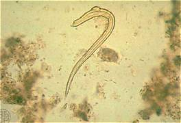 <p>Parasite or Artifact? Identify.</p>