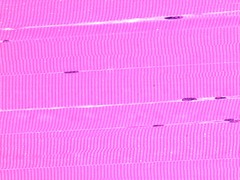 <p>- striated </p><p>- voluntary</p>